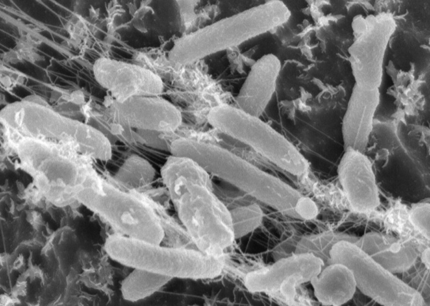 1457976809_881_Ideonella-sakaiensis-bacteria-feeding-on-plastic